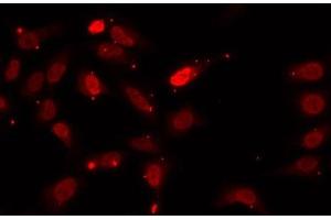 Immunofluorescence analysis of U2OS cells using HNRNPF Polyclonal Antibody (HNRNPF antibody)