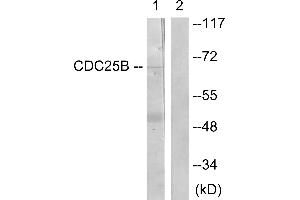 Immunohistochemistry analysis of paraffin-embedded human brain tissue using CDC25B (Ab-353) antibody.