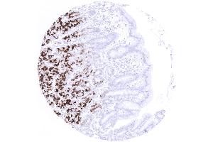 Moderate to strong MUC6 positivity in the mucous secreting glands but not the surface epithelium of the stomach (Recombinant MUC6 antibody)