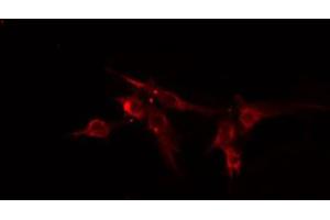 ABIN6274838 staining HeLa cells by IF/ICC. (Amphiphysin antibody  (Internal Region))