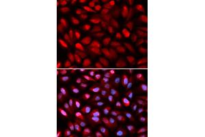 Immunofluorescence analysis of U2OS cells using PCBP2 antibody. (PCBP2 antibody)