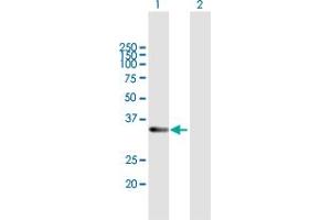 Western Blot analysis of RDH12 expression in transfected 293T cell line by RDH12 MaxPab polyclonal antibody. (RDH12 antibody  (AA 1-316))