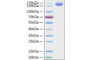 Recombinant 2019-nCoV Spike S1 Protein with hFc and His tag was determined by SDS-PAGE with Coomassie Blue, showing a band at 130-160 kDa.