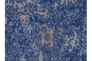Immunohistochemistry (IHC) image for anti-Mucin 1 (MUC1) (AA 474-630) antibody (ABIN7442027)