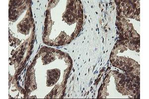 Image no. 4 for anti-Proline Synthetase Co-Transcribed (PROSC) antibody (ABIN1500440)