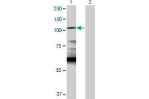 Western Blot analysis of HK1 expression in transfected 293T cell line by HK1 MaxPab polyclonal antibody. (Hexokinase 1 antibody  (AA 1-916))