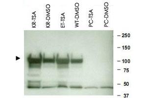 Western blot using HSP90AA1 polyclonal antibody  shows detection of a band at ~90 KDa corresponding to HSP90AA1 in various lysate preparations (arrowhead). (HSP90AA1 antibody  (AA 289-300))