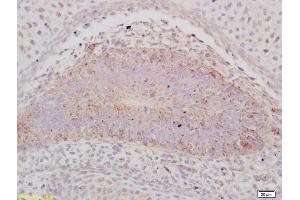 Formalin-fixed and paraffin embedded mouse embryo labeled with Anti-ABCA12 Polyclonal Antibody, Unconjugated (ABIN1386605) at 1:200 followed by conjugation to the secondary antibody and DAB staining (ABCA12 antibody  (AA 2051-2200))