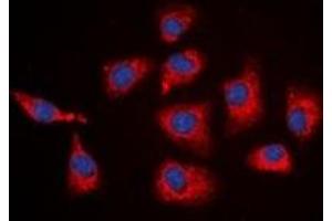 Immunofluorescent analysis of SGK1 staining in HEK293T cells.