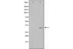 Western blot analysis of RFA2 phosphorylation expression in Adriamycin treated HeLa whole cell lysates,The lane on the left is treated with the antigen-specific peptide. (RPA2 antibody  (pThr21))