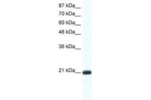 Western Blotting (WB) image for anti-Retina and Anterior Neural Fold Homeobox 2 (RAX2) antibody (ABIN2461283) (RAX2 antibody)