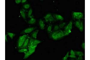 Immunofluorescent analysis of Hela cells using ABIN7163052 at dilution of 1:100 and Alexa Fluor 488-congugated AffiniPure Goat Anti-Rabbit IgG(H+L) (PHF21A antibody  (AA 312-487))