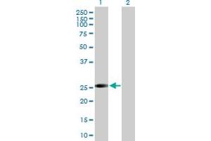 Western Blot analysis of VAPB expression in transfected 293T cell line by VAPB MaxPab polyclonal antibody. (VAPB antibody  (AA 1-243))