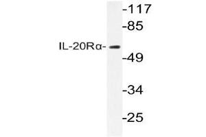 Western blot (WB) analysis of IL-20Rlha antibody in extracts from HepG2 cells. (IL20RA antibody)