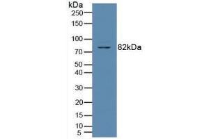 Western blot analysis of Human Jurkat Cells. (PKC theta antibody  (AA 380-634))