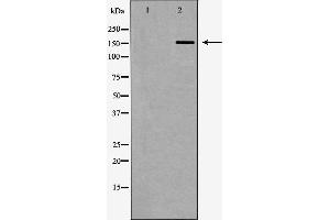 Western blot analysis of Hela whole cell lysates, using FANCD2 Antibody. (FANCD2 antibody  (Internal Region))