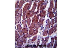 FIZ1 antibody  (C-Term)