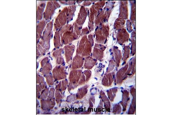 FIZ1 antibody  (C-Term)