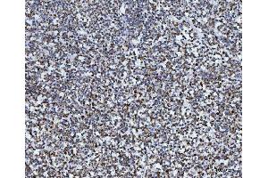 IHC analysis of TOMM40 using anti-TOMM40 antibody (ABIN7599738).