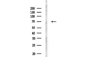 anti-ClpB Caseinolytic Peptidase B Homolog (CLPB) (Internal Region) antibody