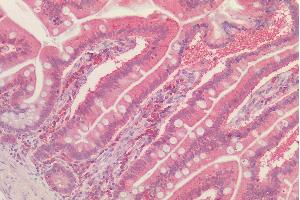 (ABIN308466) (2. (Peroxiredoxin 1 antibody  (Internal Region))