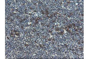 Image no. 14 for anti-Ubiquitin-Conjugating Enzyme E2, J1, U (UBE2J1) antibody (ABIN1501637)