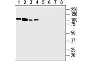 Western blot analysis of human Jurkat T-cell leukemia cell line lysate (lanes 1 and 5), human K562 chronic myelogenous leukemia cell line lysate (lanes 2 and 6), human Malme-3M melanoma cell line lysate (lanes 3 and 7) and human HT-29 colorectal adenocarcinoma cell line lysate (lanes 4 and 8): - 1-4. (EPH Receptor A3 antibody  (Extracellular, N-Term))