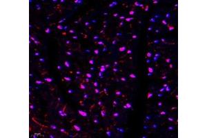 Immunofluorescence of paraffin embedded mouse heart using TYW1B (ABIN7076025) at dilution of 1: 650 (400x lens) (TYW1B antibody)