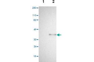 Western blot analysis of Lane 1: Human cell line RT-4, Lane 2: Human cell line U-251MG sp with SPARC polyclonal antibody .