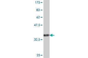 Western Blot detection against Immunogen (36. (CADPS antibody  (AA 1256-1353))