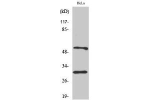 Western Blotting (WB) image for anti-Caspase 10 B/C antibody (ABIN5956727) (Caspase 10 B/C antibody)