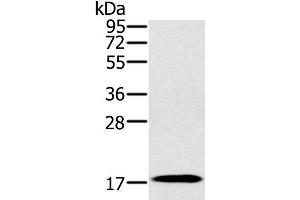 Western Blot analysis of Mouse heart tissue using RNF122 Polyclonal Antibody at dilution of 1:300 (RNF122 antibody)