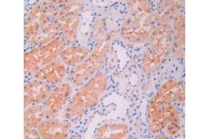 Figure. (JAK2 antibody  (AA 508-800))