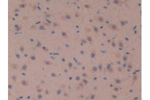 IHC-P analysis of Mouse Brain Tissue, with DAB staining.