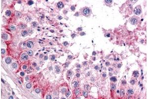 Human Testis: Formalin-Fixed, Paraffin-Embedded (FFPE) (TLN1 antibody  (AA 1052-1150))