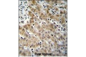 EDN1 Antibody (C-term) (ABIN655912 and ABIN2845311) immunohistochemistry analysis in formalin fixed and paraffin embedded human liver tissue followed by peroxidase conjugation of the secondary antibody and DAB staining. (Endothelin 1 antibody  (C-Term))