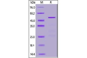 2019-nCoV (COVID-19) Nucleocapsid protein, His Tag on SDS-PAGE under reducing (R) condition. (SARS-CoV-2 Nucleocapsid Protein (SARS-CoV-2 N) (His tag))