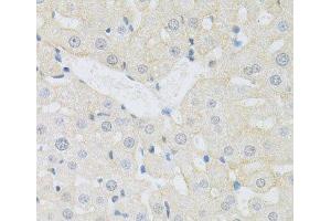 Immunohistochemistry of paraffin-embedded Rat liver using CD98 Polyclonal Antibody at dilution of 1:100 (40x lens). (SLC3A2 antibody)