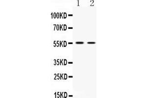 Western blot analysis of SLC18A3 expression in HELA whole cell lysates ( Lane 1) and HEPA whole cell lysates ( Lane 2). (SLC18A3 antibody  (N-Term))