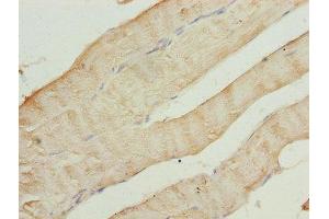 Immunohistochemistry of paraffin-embedded human skeletal muscle tissue using ABIN7143358 at dilution of 1:100 (CAP2 antibody  (AA 221-477))