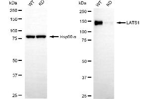 Western blotting analysis using LATS1 antibody (ABIN7799240).