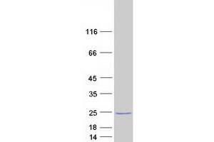 Validation with Western Blot (OMP Protein (Myc-DYKDDDDK Tag))