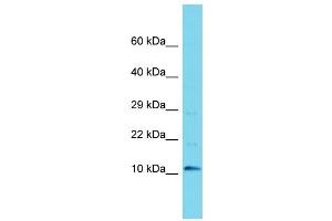 Western Blotting (WB) image for anti-Chromosome 9 Open Reading Frame 170 (C9ORF170) (N-Term) antibody (ABIN2156511)