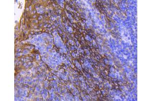 Paraformaldehyde-fixed, paraffin embedded human tonsil, Antigen retrieval by boiling in sodium citrate buffer (pH6) for 15min, Block endogenous peroxidase by 3% hydrogen peroxide for 30 minutes, Blocking buffer at 37°C for 20min, Antibody incubation with Cytokeratin 13 (5A3) Monoclonal Antibody  at 1:50 overnight at 4°C, followed by a conjugated secondary and DAB staining. (Cytokeratin 13 antibody)