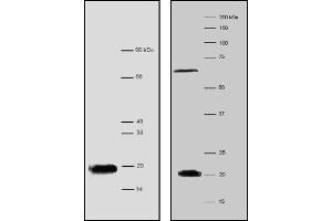 Western Blotting (WB) image for anti-Processing of Precursor 7, Ribonuclease P/MRP Subunit (POP7) antibody (ABIN1108698) (POP7 antibody)