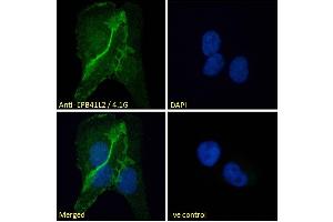 ABIN238594 Immunofluorescence analysis of paraformaldehyde fixed U2OS cells, permeabilized with 0. (EPB41L2 antibody  (Internal Region))