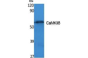 Western Blotting (WB) image for anti-Calcium/calmodulin-Dependent Protein Kinase II delta (CAMK2D) (Internal Region) antibody (ABIN3180971) (CAMK2D antibody  (Internal Region))