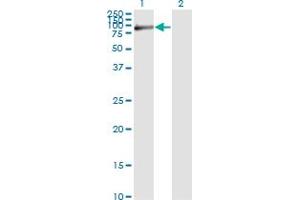 Western Blot analysis of FBLN1 expression in transfected 293T cell line by FBLN1 monoclonal antibody (M01), clone 4C9. (Fibulin 1 antibody  (AA 151-250))