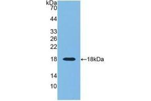 Detection of Recombinant RNASE3, Human using Monoclonal Antibody to Ribonuclease A3 (RNASE3) (RNASE3 antibody  (AA 30-154))