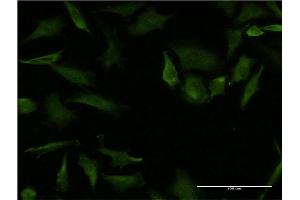 Immunofluorescence of monoclonal antibody to RHOA on HeLa cell. (RHOA antibody  (AA 1-193))